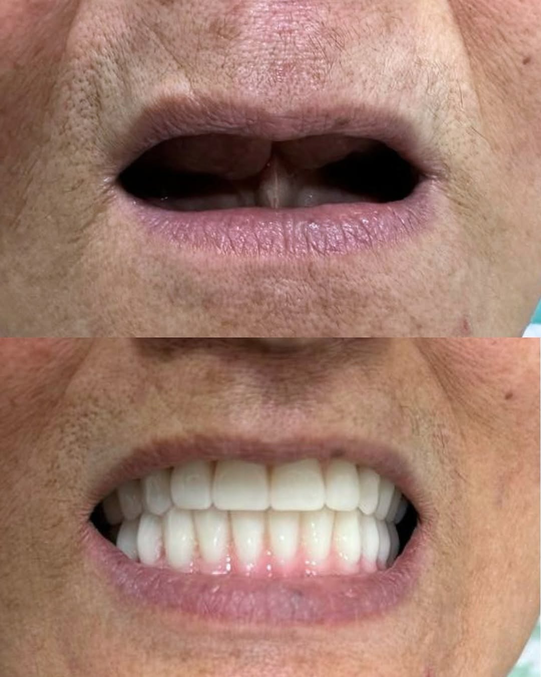 Antes e Depois — Caso 3